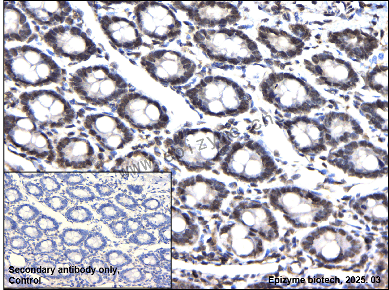 Anti-LIM Kinase 1 Rabbit mAb [42C37C10]