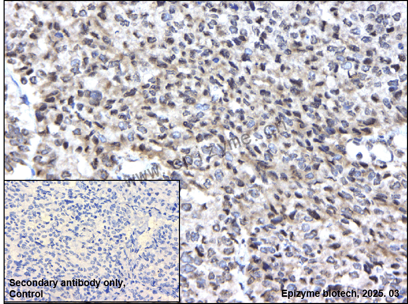 Anti-LIM Kinase 1 Rabbit mAb [42C37C10]