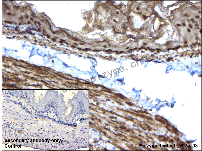 Anti-LIM Kinase 1 Rabbit mAb [42C37C10]