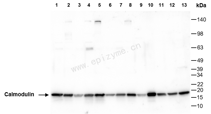 Anti-Calmodulin 1/2/3 Rabbit mAb [25H89L75]