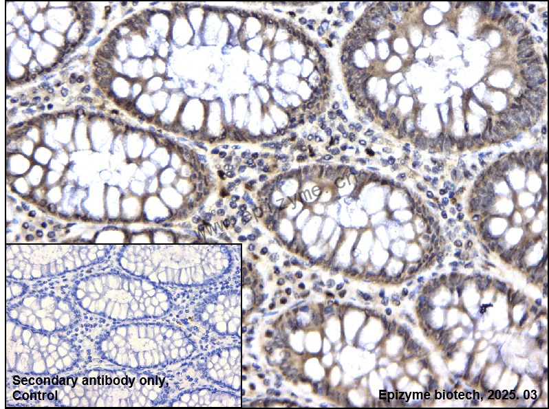 Anti-CKII alpha Rabbit mAb [84I13J89]
