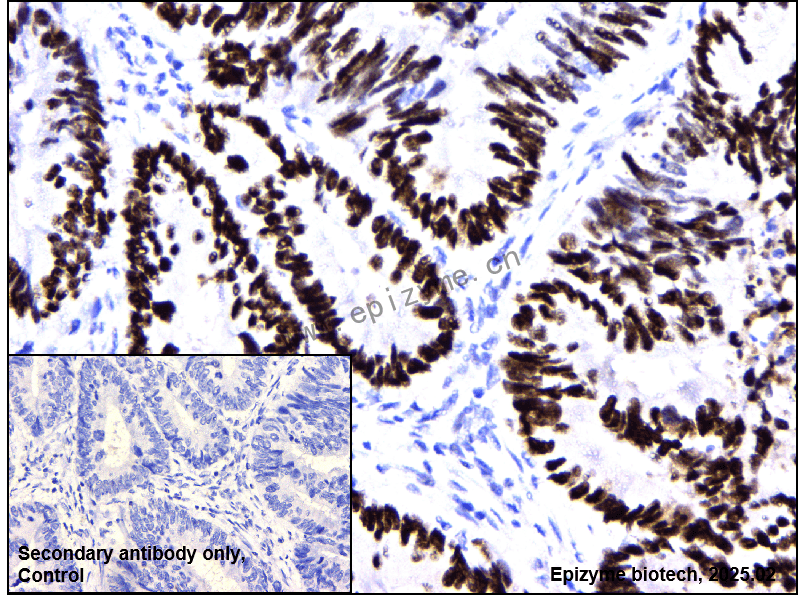 Anti-p53 Rabbit mAb [88T68J59]