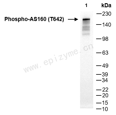 Anti-Phospho-AS160 (Thr642) Rabbit mAb [53S29F87]