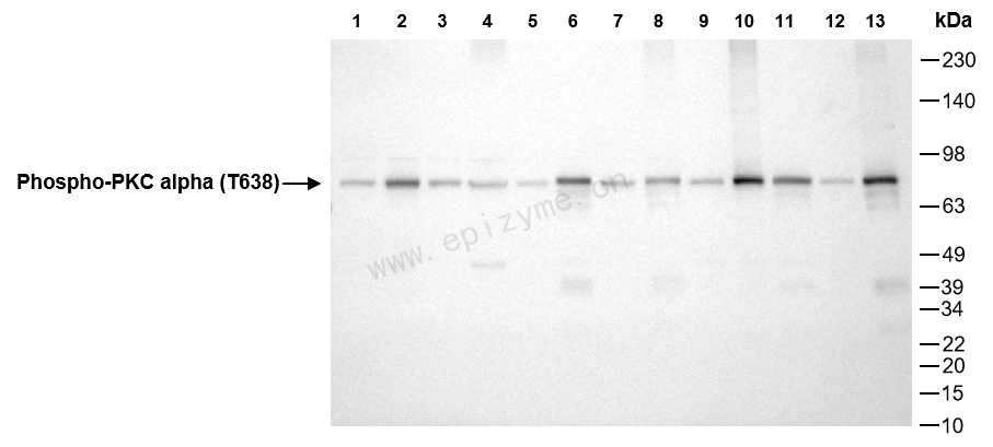 Anti-Phospho-PKC alpha (Thr638) Rabbit mAb [12M78C85]