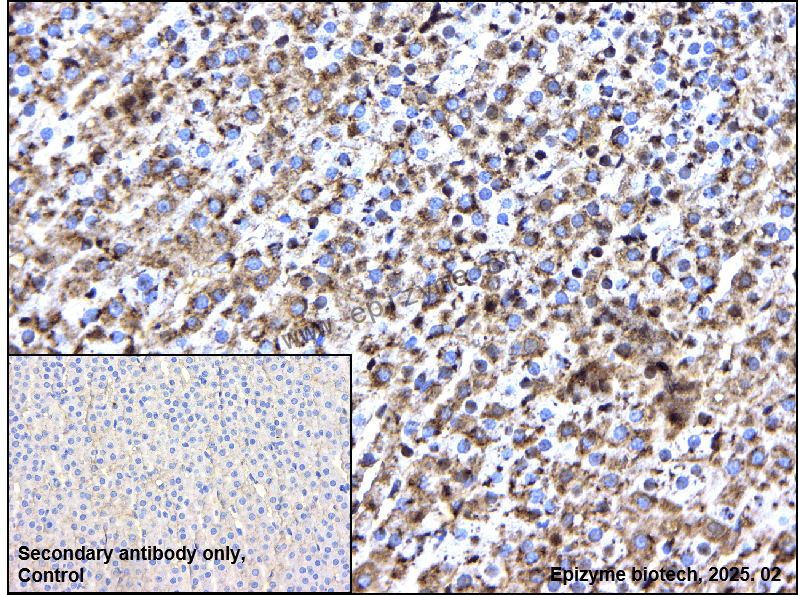 Anti-Phospho-PKC alpha (Thr638) Rabbit mAb [12M78C85]