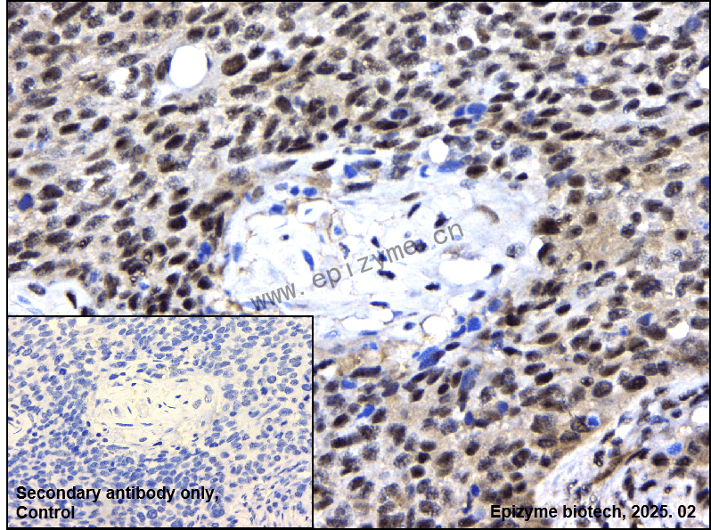 Anti-Phospho-PKC alpha (Thr638) Rabbit mAb [12M78C85]