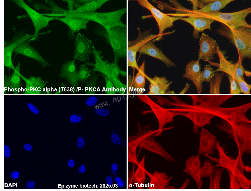 Anti-Phospho-PKC alpha (Thr638) Rabbit mAb [12M78C85]