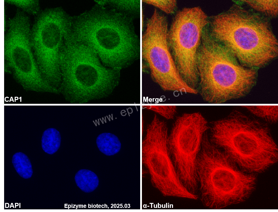 Anti-CAP1 Rabbit mAb [39H63I59]