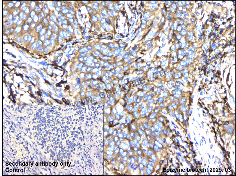 Anti-CAP1 Rabbit mAb [39H63I59]