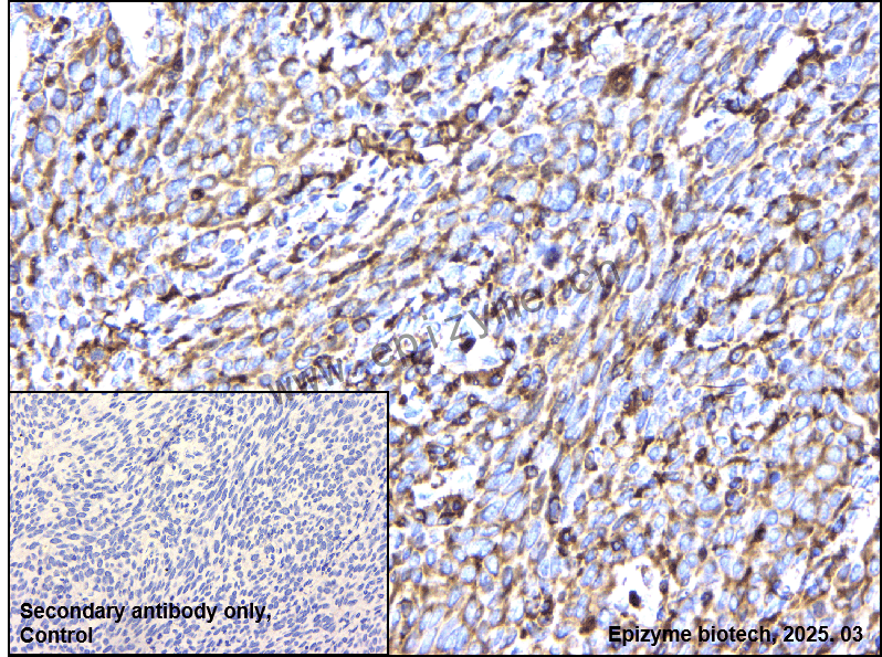 Anti-CAP1 Rabbit mAb [39H63I59]