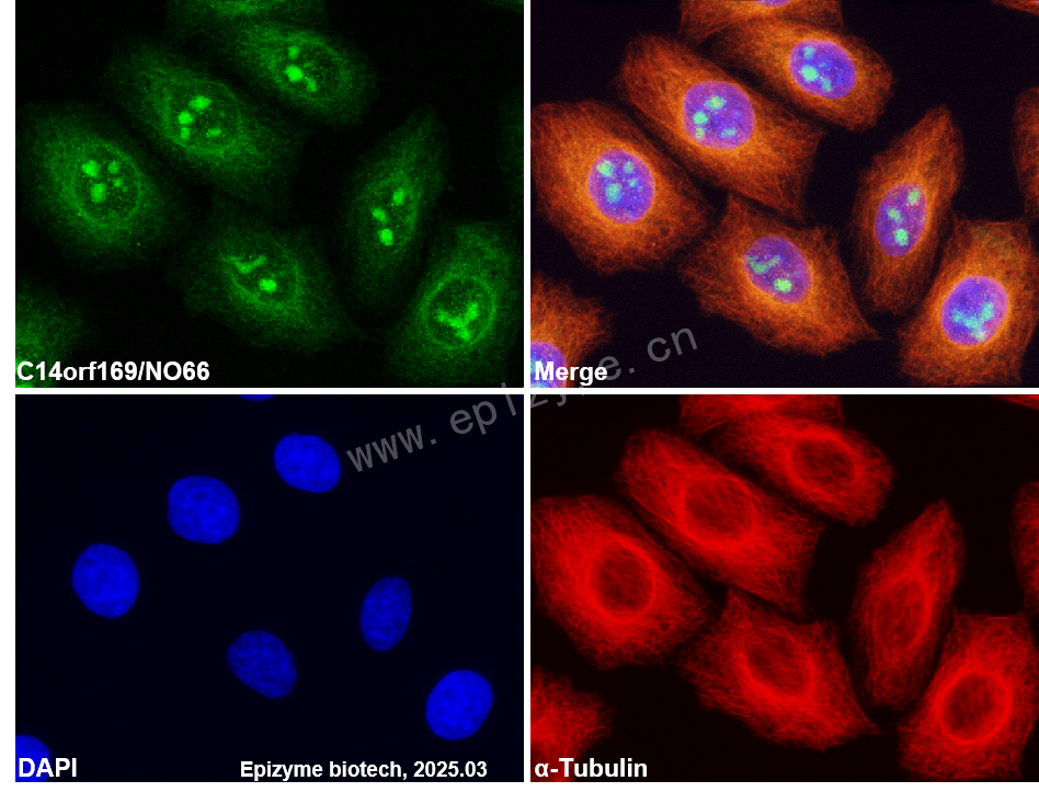 Anti-C14orf169/NO66 Rabbit mAb [63T90M41]
