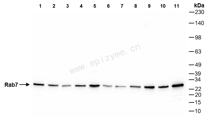 Anti-RAB7 Rabbit mAb [75K01T16]