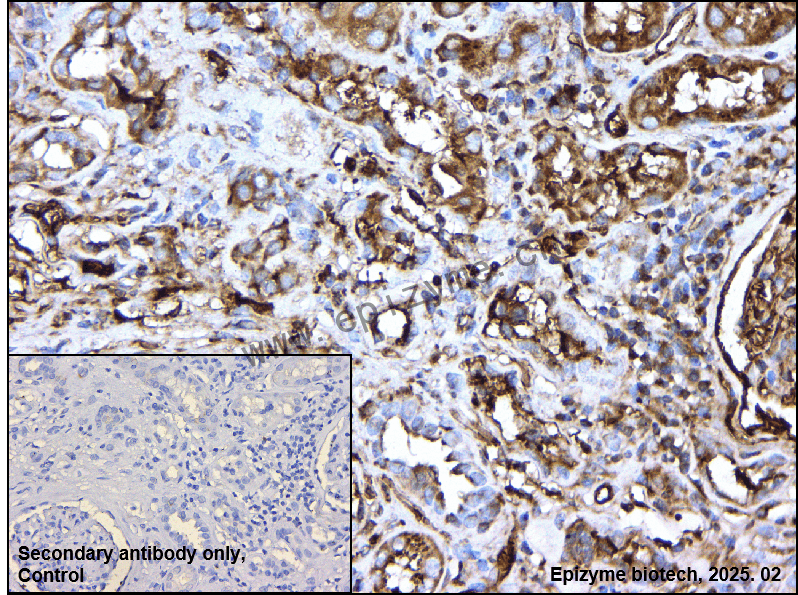 Anti-RAB7 Rabbit mAb [75K01T16]