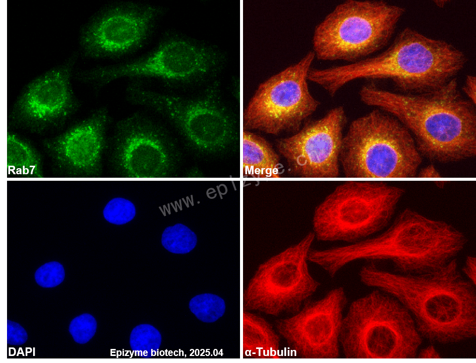 Anti-RAB7 Rabbit mAb [75K01T16]