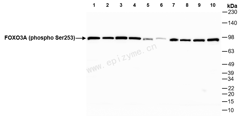 Anti-Phospho-FOXO3A (Ser253) Rabbit mAb [75N04B25]