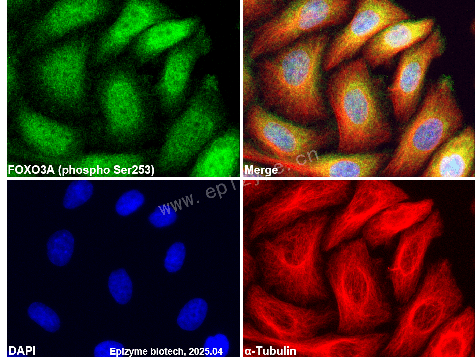 Anti-Phospho-FOXO3A (Ser253) Rabbit mAb [75N04B25]
