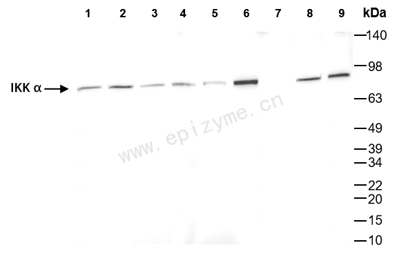 Anti-IKK alpha Rabbit mAb [90J36Q24]