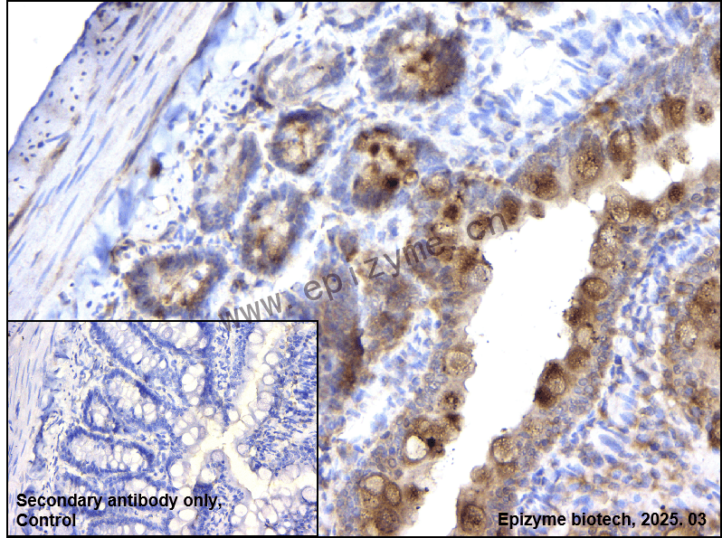 Anti-IKK alpha Rabbit mAb [90J36Q24]