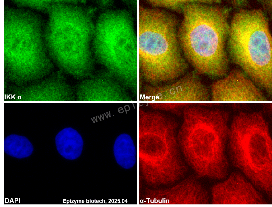 Anti-IKK alpha Rabbit mAb [90J36Q24]