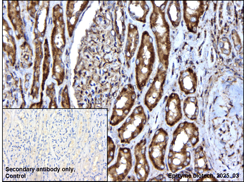 Anti-Phospho-VASP (Ser156) Rabbit mAb [22L31N76]