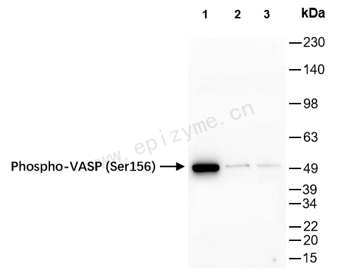 Anti-Phospho-VASP (Ser156) Rabbit mAb [22L31N76]