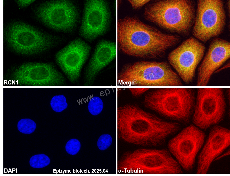 Anti-RCN1/RCN Rabbit mAb [63E12P21]