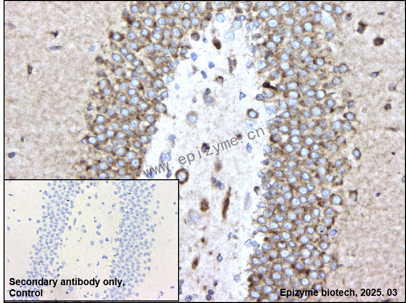 Anti-RCN1/RCN Rabbit mAb [63E12P21]