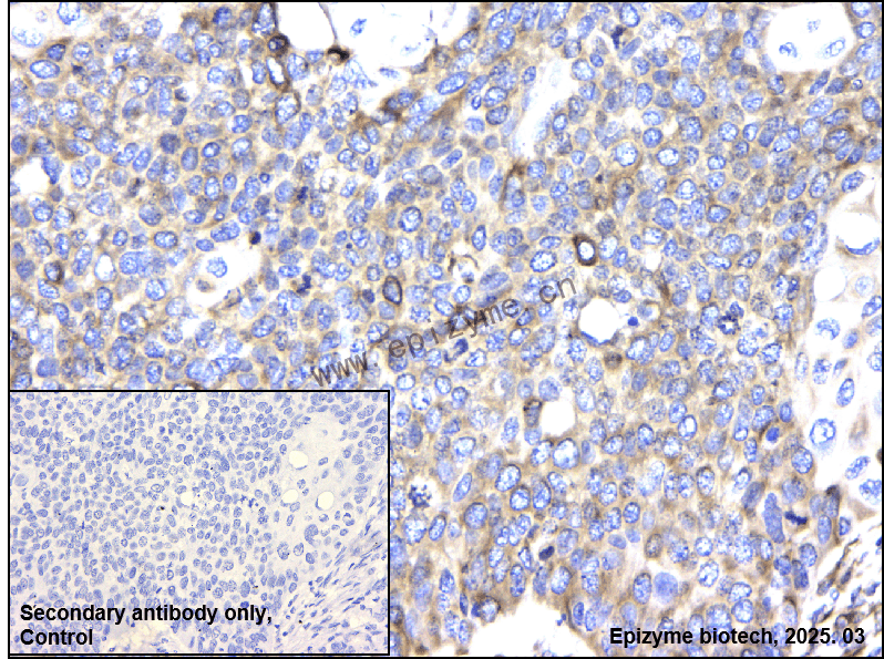 Anti-RCN1/RCN Rabbit mAb [63E12P21]