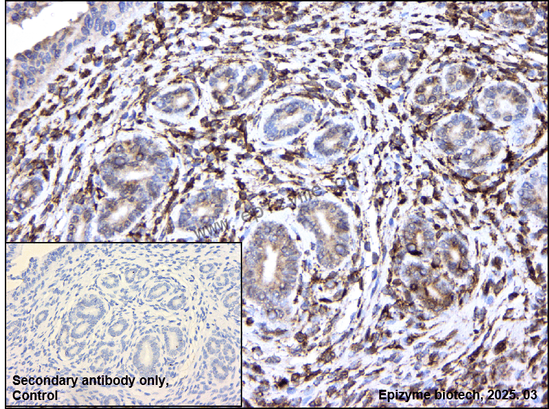 Anti-RCN1/RCN Rabbit mAb [63E12P21]