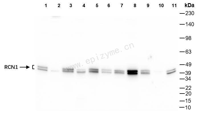 Anti-RCN1/RCN Rabbit mAb [63E12P21]