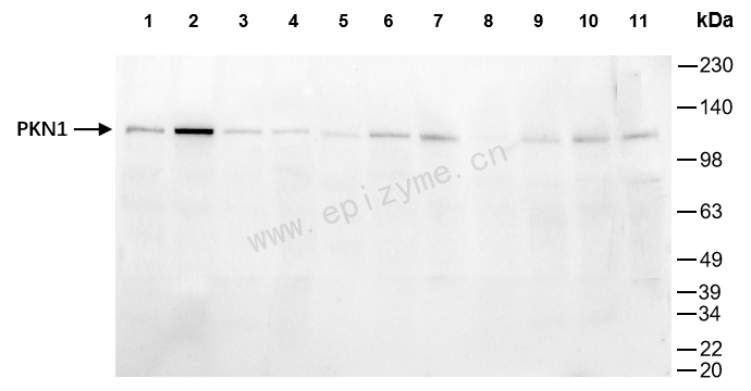 Anti-PKN1 Rabbit mAb [65C51C39]