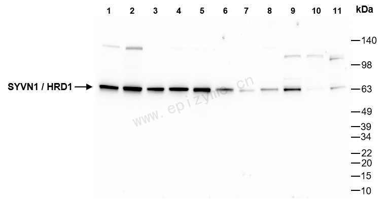 Anti-SYVN1/HRD1 Rabbit mAb [40M82P85]