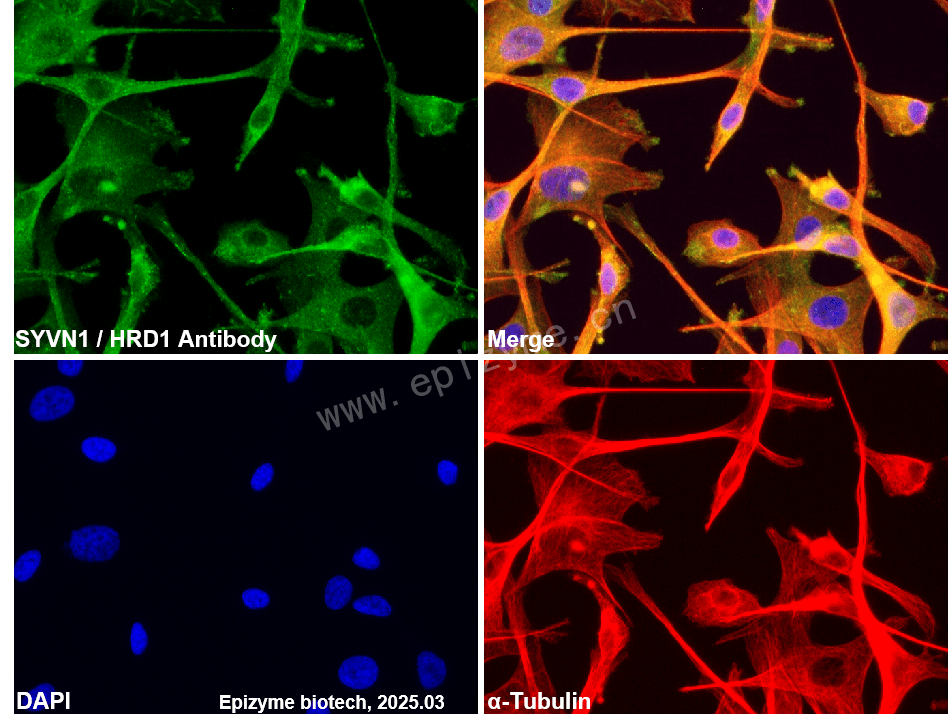 Anti-SYVN1/HRD1 Rabbit mAb [40M82P85]