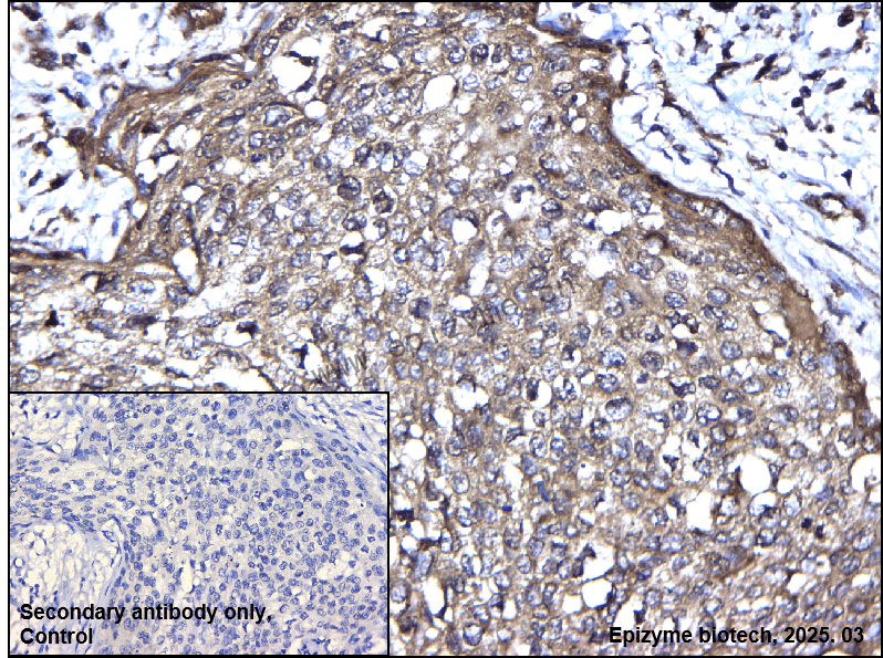 Anti-SYVN1/HRD1 Rabbit mAb [40M82P85]