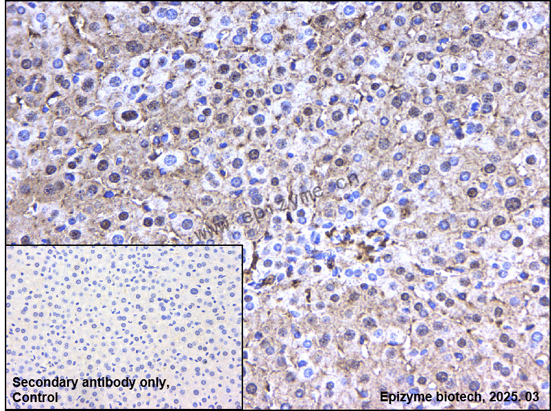 Anti-SYVN1/HRD1 Rabbit mAb [40M82P85]