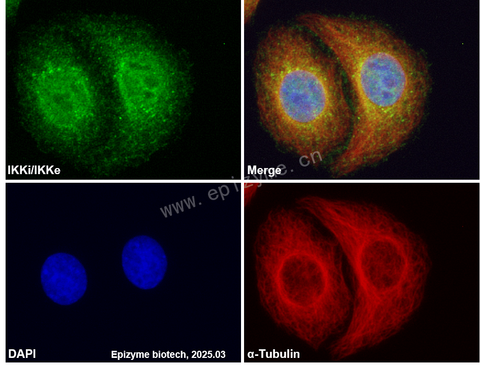 Anti-IKKi/IKKe Rabbit mAb [15E63C87]