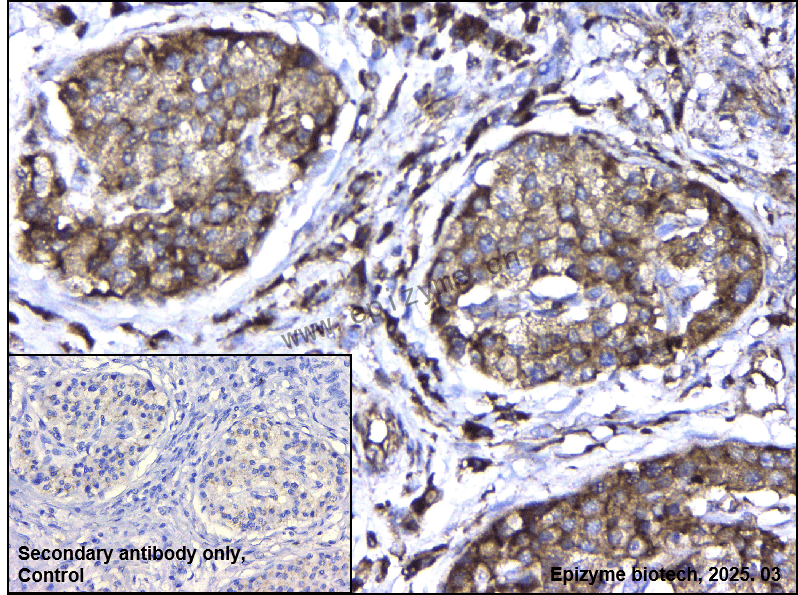 Anti-IKKi/IKKe Rabbit mAb [15E63C87]