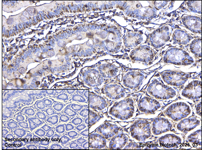 Anti-MARK3 Rabbit mAb [95N55L56]