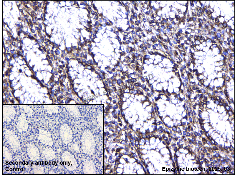Anti-MARK3 Rabbit mAb [95N55L56]