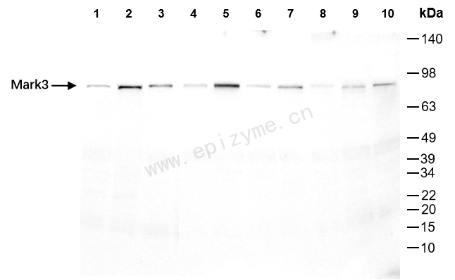 Anti-MARK3 Rabbit mAb [95N55L56]