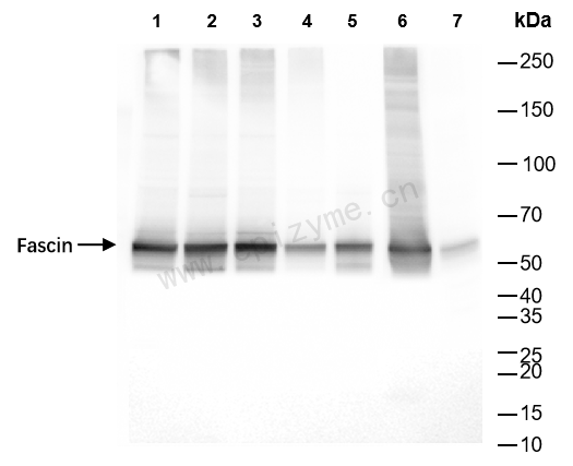 Anti-Fascin Rabbit mAb [15I54C24]