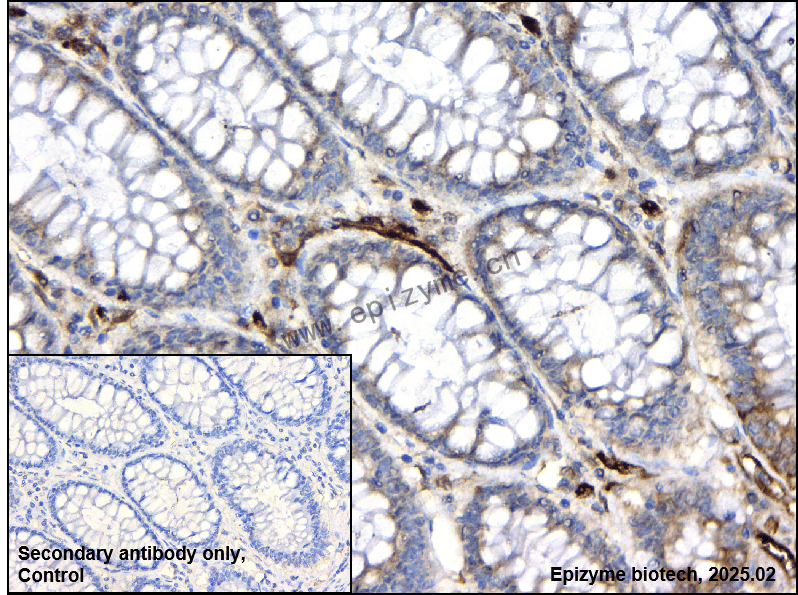 Anti-Fascin Rabbit mAb [15I54C24]