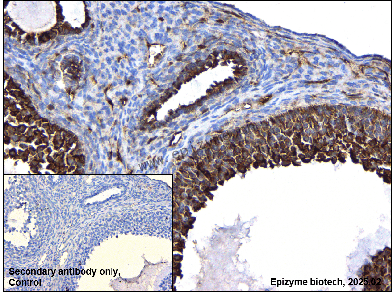 Anti-Fascin Rabbit mAb [15I54C24]
