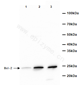 Anti-BCL2 Rabbit mAb [47A21F24]