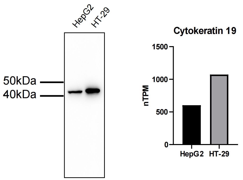Anti-Cytokeratin 19 Rabbit pAb