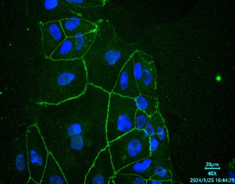 Anti-ZO-1 Mouse mAb [24D02C18]