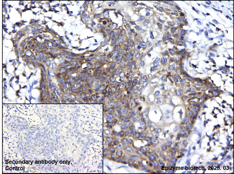 Anti-PARP2 Rabbit mAb [25E82L86]