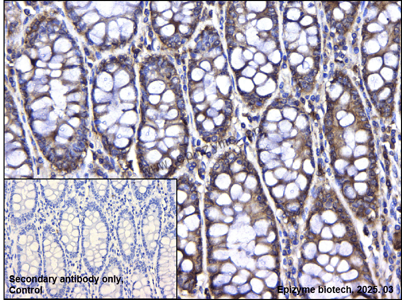 Anti-PARP2 Rabbit mAb [25E82L86]