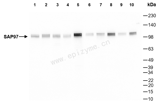 Anti-SAP97 Rabbit mAb [82B13I47]