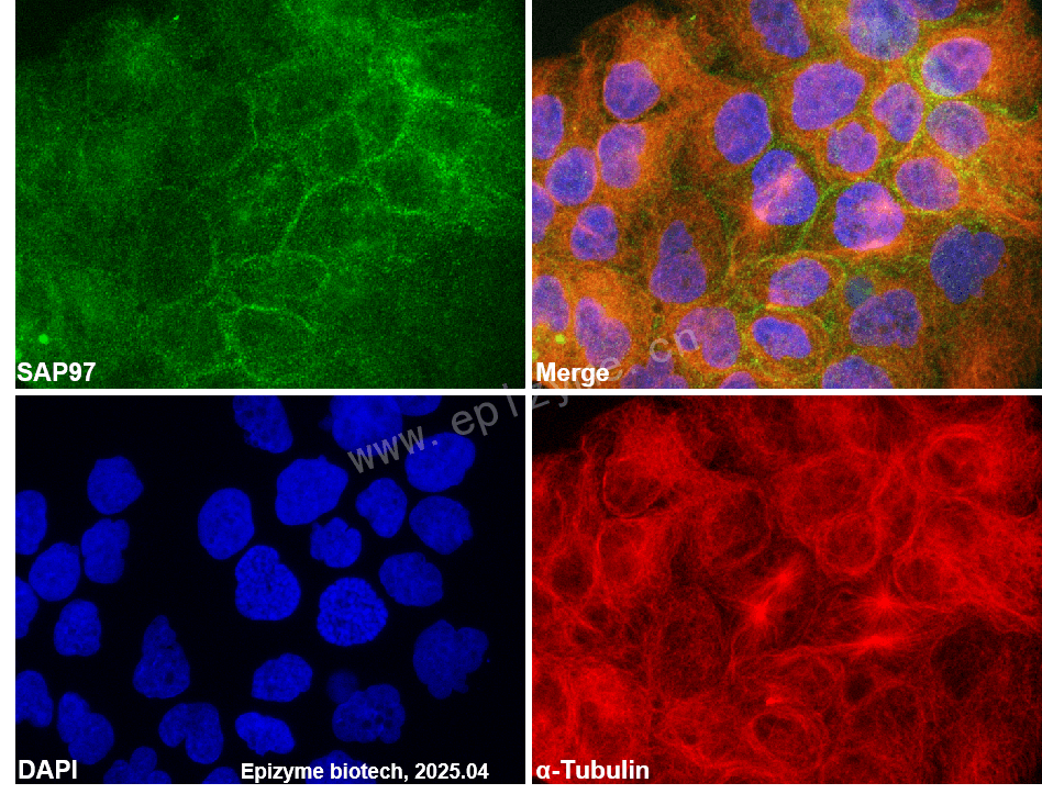 Anti-SAP97 Rabbit mAb [82B13I47]